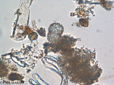 phyto/Scattered_Islands/europa/COMMA April 2011/Woronichinia sp (ancien Ind 7)(copy)_thumb.jpg